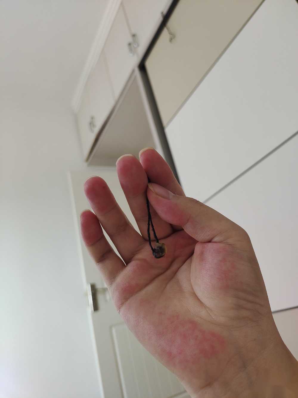 移植23天出血是好事还是胎停？