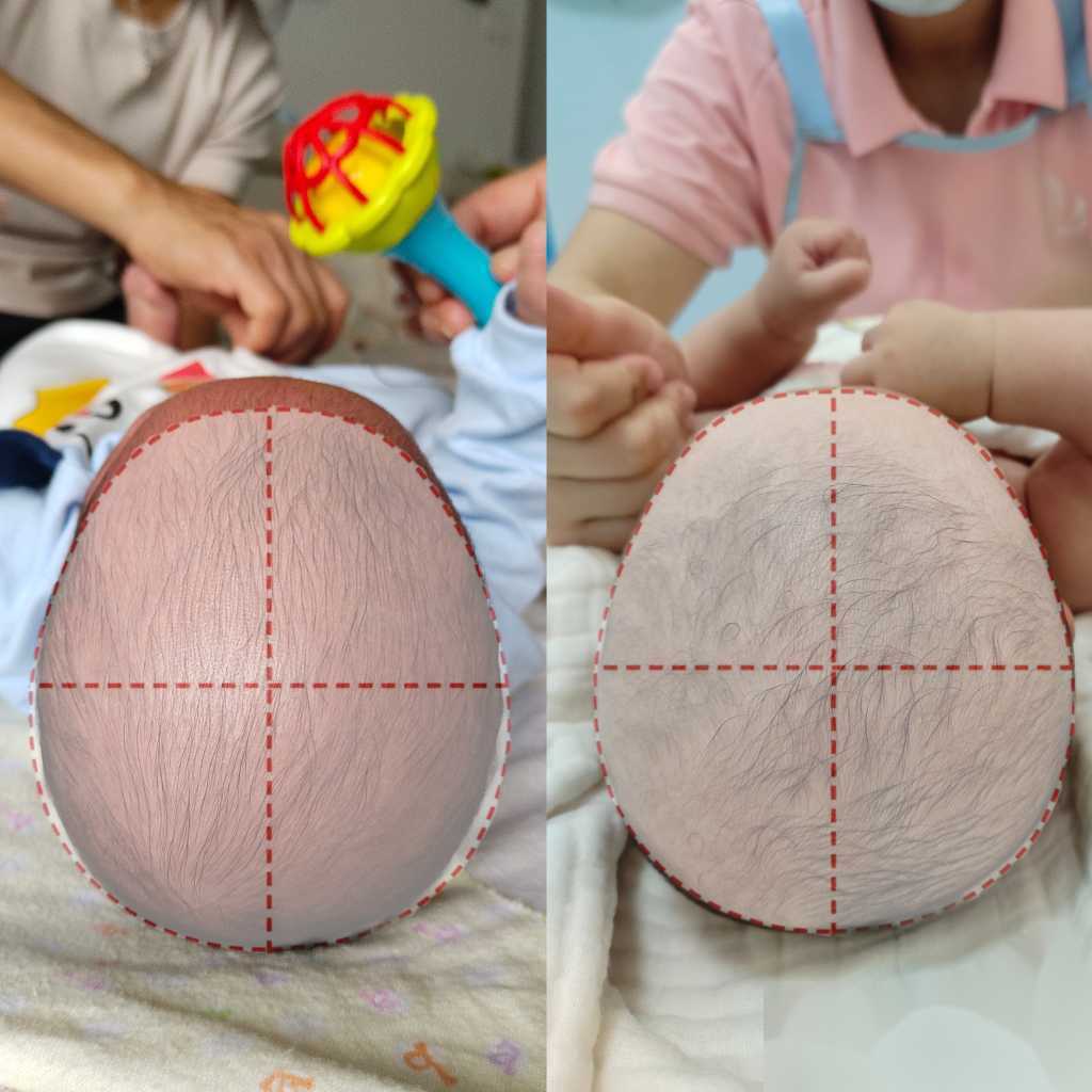 私人高薪请代妈~多巢卵巢综合症的症状