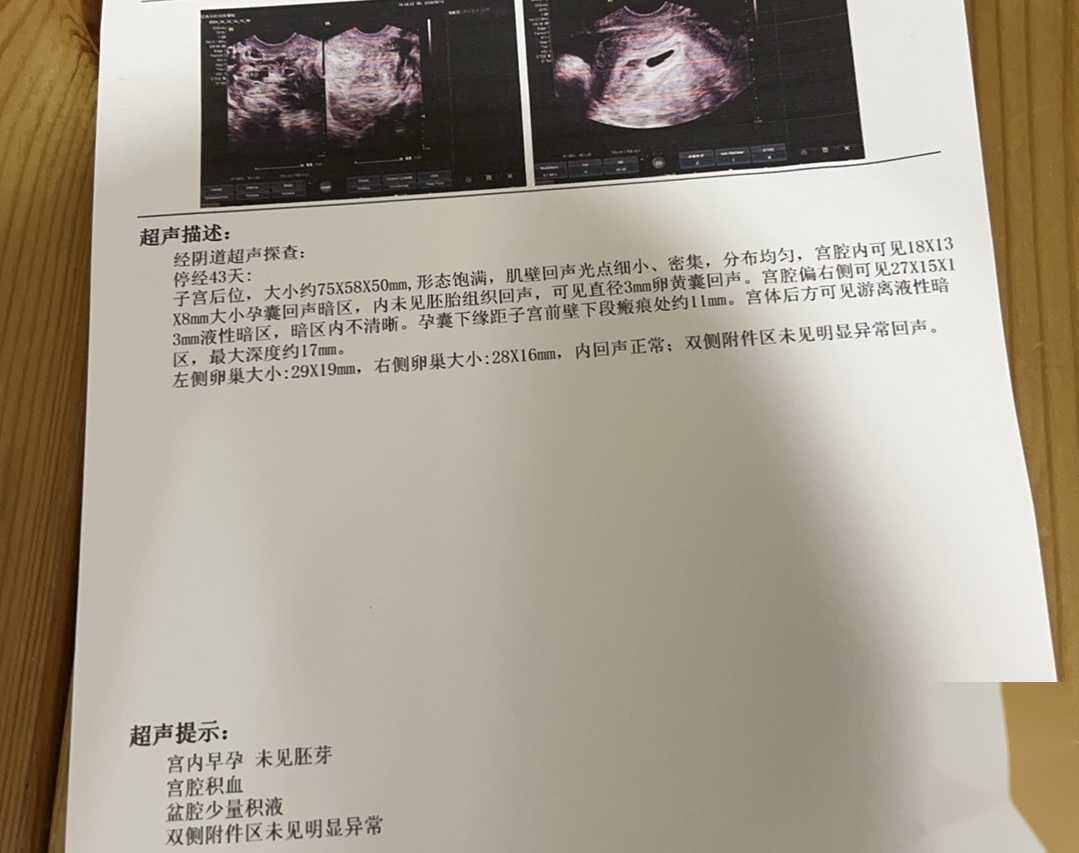 3号染色体异常做试管的成功率